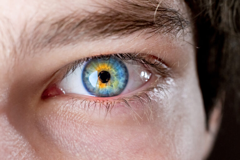 HPPD and Visual Snow: Get Expert Support from Dr. Steven Locke